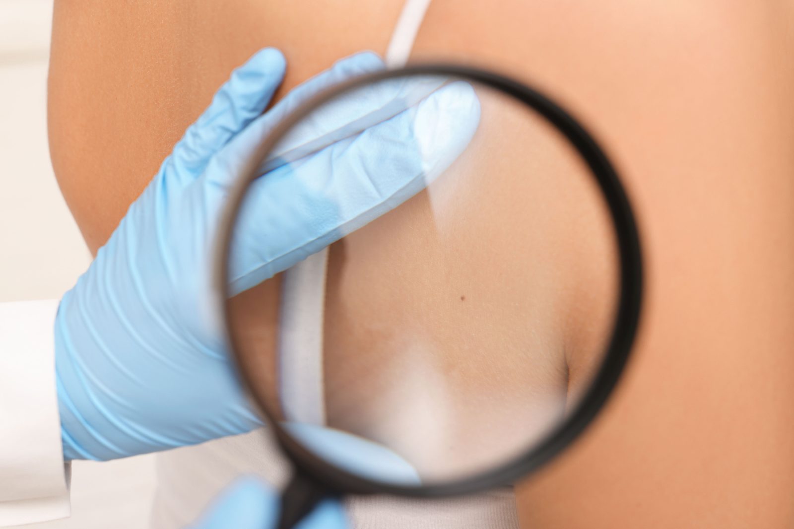 Moje sanje, postati dermatolog, se bodo uresničile